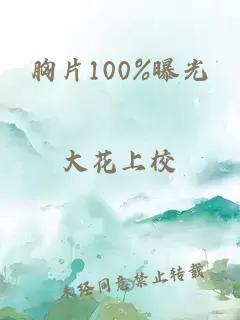 胸片100%曝光